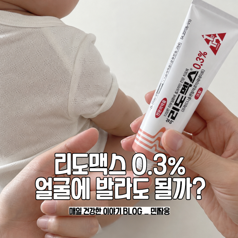 리도멕스 0.3 아기 얼굴에 발라도 될까?처방받는 방법과 사용법