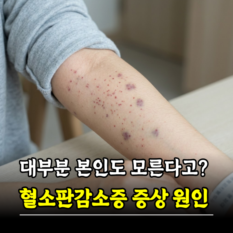 대부분 본인도 모른 채 지낸다고? 혈소판감소증 증상 원인, 혈소판정상수치
