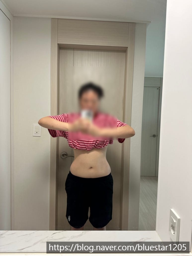 [마운자로] 86KG 고도비만 마운자로 _19주 차 후기 & 20주 차 눈바디