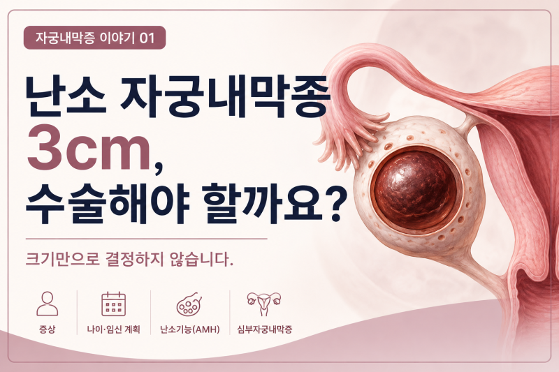 난소 자궁내막종 3cm, 꼭 수술해야 할까요?