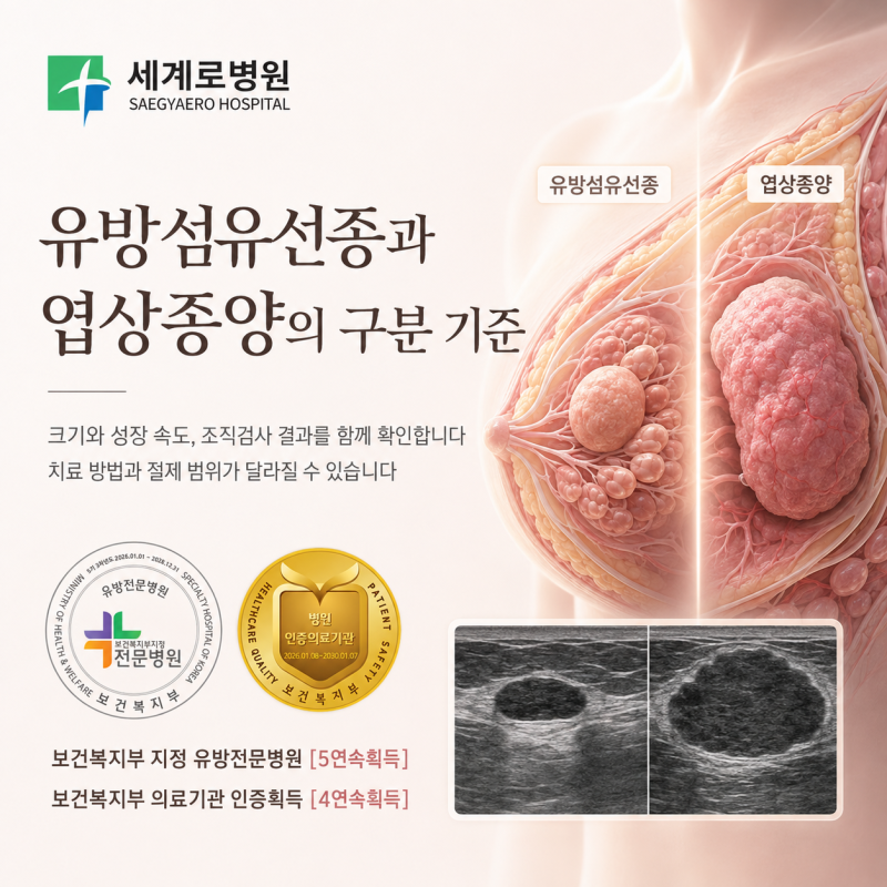 유방섬유선종과 엽상종양의 구분 기준