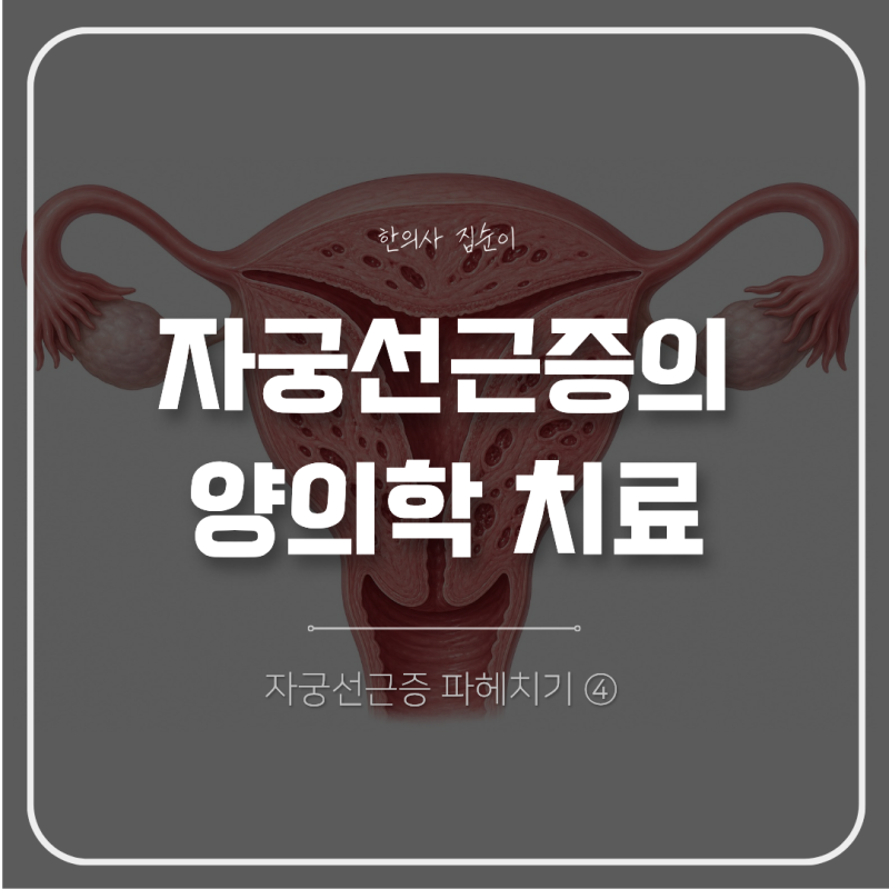 자궁선근증 양의학 치료, 미레나부터 하이푸·수술까지 무엇이 다를까?