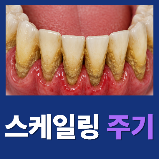 스케일링 주기, 1년에 한 번이 정답일까요?