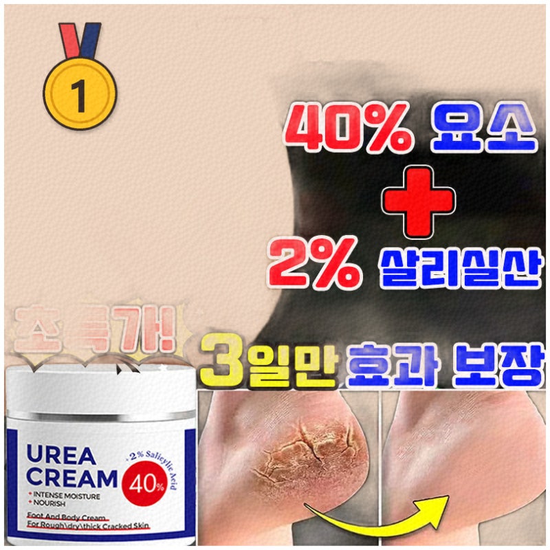 유레아크림으로 건강한 발피부 만들기 추천 상품 모음
