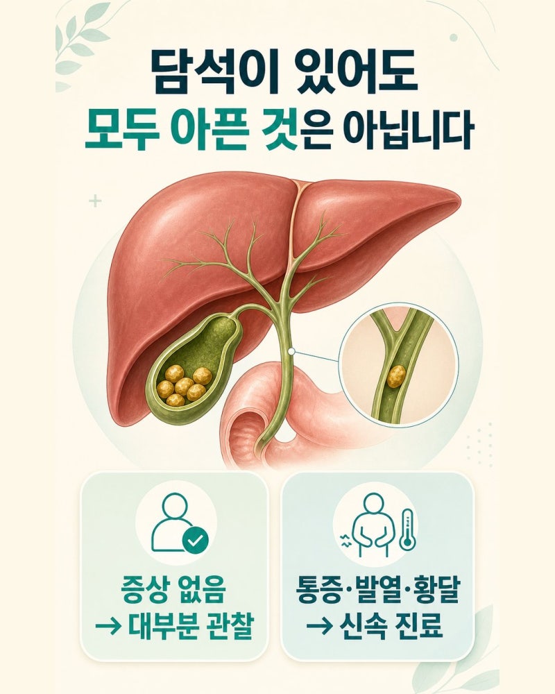 담석증 초기증상과 담낭염으로 진행할 때 나타나는 신호