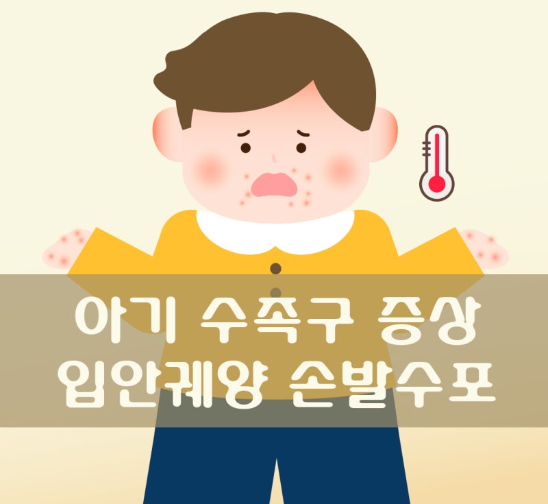 아기 수족구 증상 입안궤양부터 손발수포까지 대처법