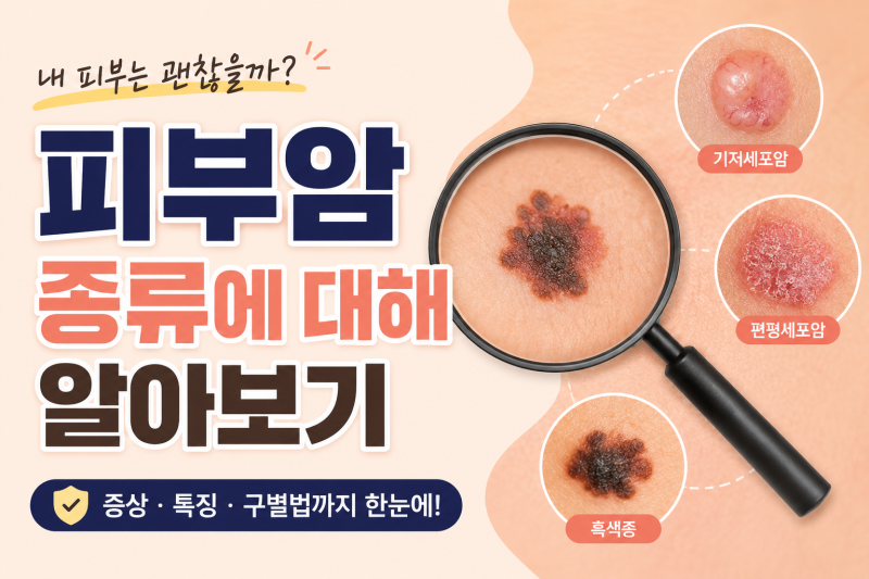 다양한 피부암 종류에 대해 알아보기