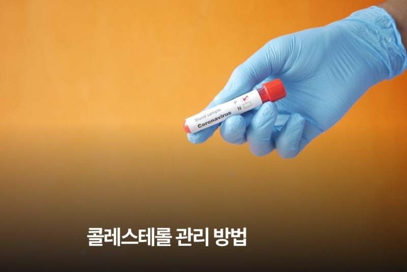 덜 먹는게 정답은 아니다…콜레스테롤, 뭘 줄여야 할까