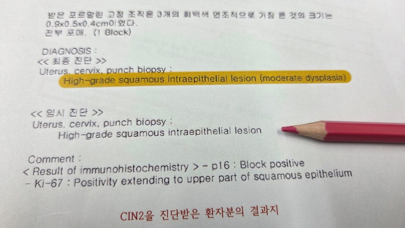 자궁경부이형성증 2단계 CIN2 자연회복 가능성 있을지 궁금해요