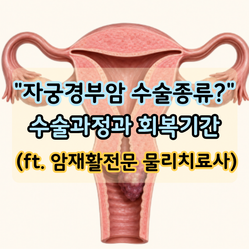 "자궁경부암 수술 종류 4가지?" 수술 과정과 회복기간 정리 (ft.암재활전문 물리치료사)