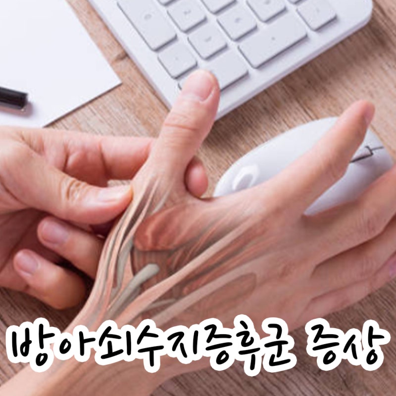 손가락 펼 때 딸깍 소리! 방아쇠수지증후군 초기 증상과 원인 스트레칭하기
