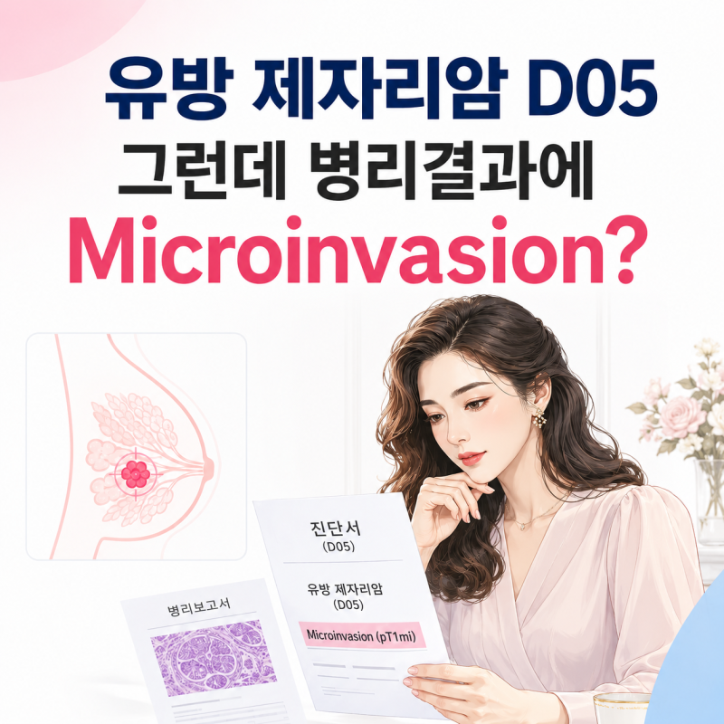 유방 제자리암 D05인데 병리결과에 Microinvasion이 있다면｜진단서보다 다시 봐야 할 한 줄