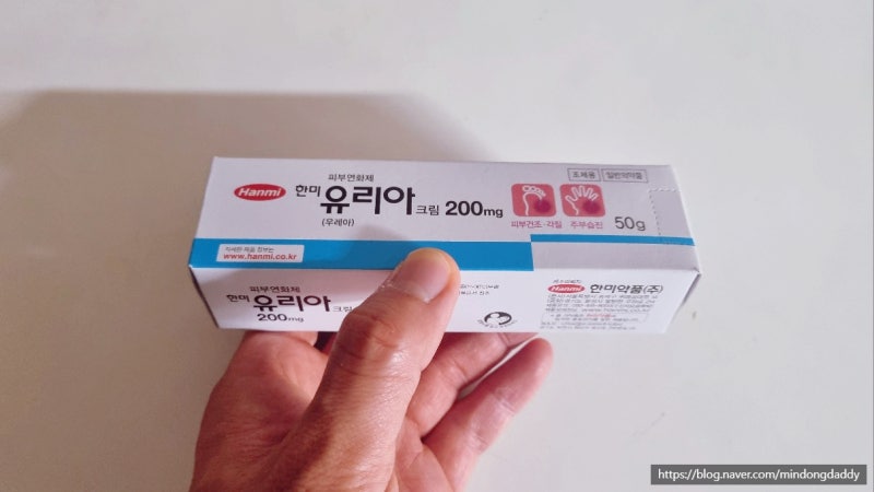 발가락 손가락 습진 치료 연고 "유리아 크림" 주부습진 추천! (습진원인 이유)