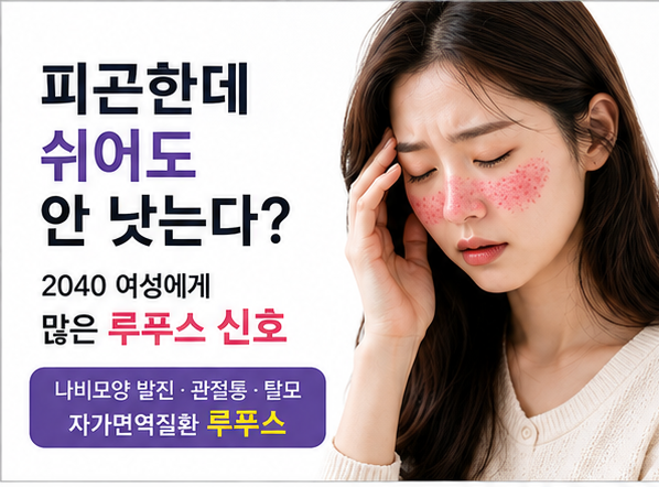 쉬어도 피곤하다면? 2040 여성에게 많은 자가면역질환 '루푸스'의 신호들