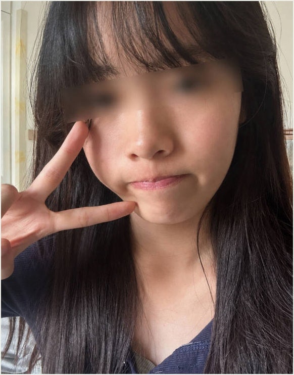 다이소 시카토너패드 한 달 실사용 변화