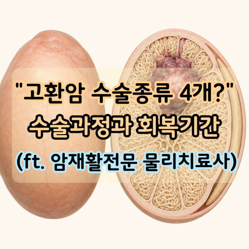 "고환암 수술 종류 4가지?" 수술 과정과 회복기간 정리 (ft. 암재활전문 물리치료사)