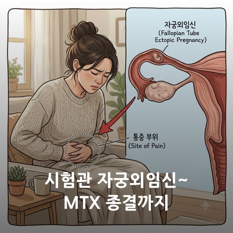 시험관 자궁외임신 증상, 원인, 통증, mtx 주사후기, 부작용