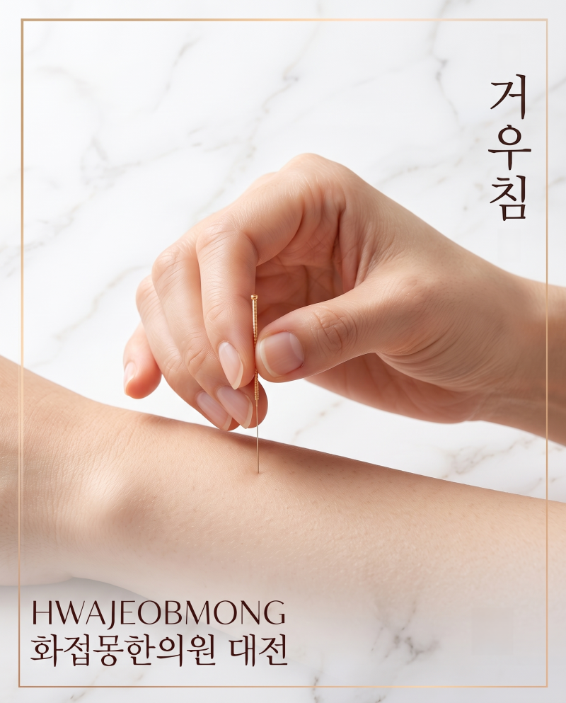 대전거우침) 침으로 편평사마귀를 제거해요? 거우침이란?