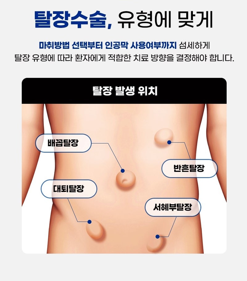 탈장 진단은 받았는데 탈장 비용이 걱정돼서 망설이고 있다면? 먼저 확인해봐야 하는 것들 [....