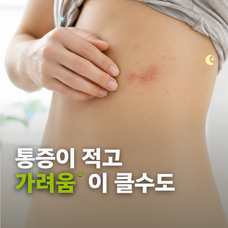 대상포진 증상 가려움 물집 초기증상과 치료 시기