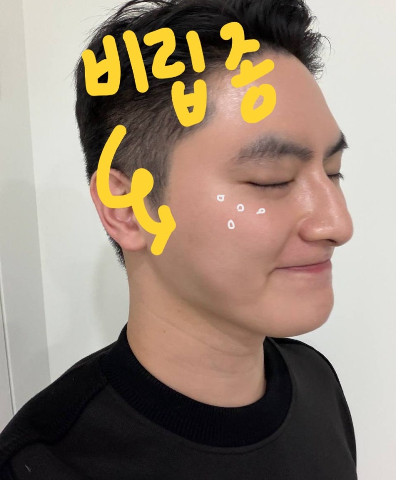 천안비립종제거 피부과, 손으로 짜기 전에 이 글을 필독