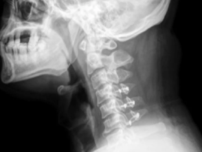 목 MRI 비용 병원가기 전에 알아두세요