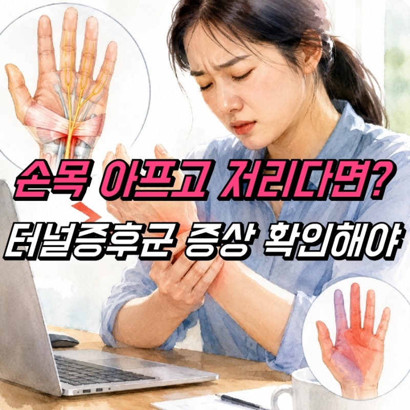 손목 터널증후군 증상, 손목통증 운동 수술 치료법