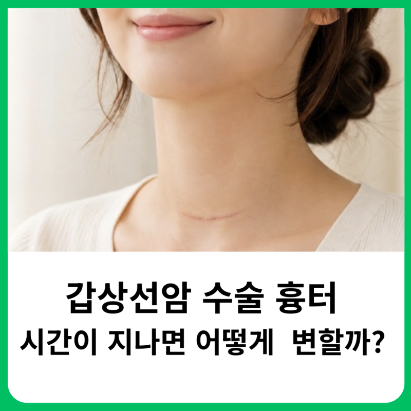 갑상선암 수술후 흉터 시간이 지나면 없어질까? 시기별 관리 방법