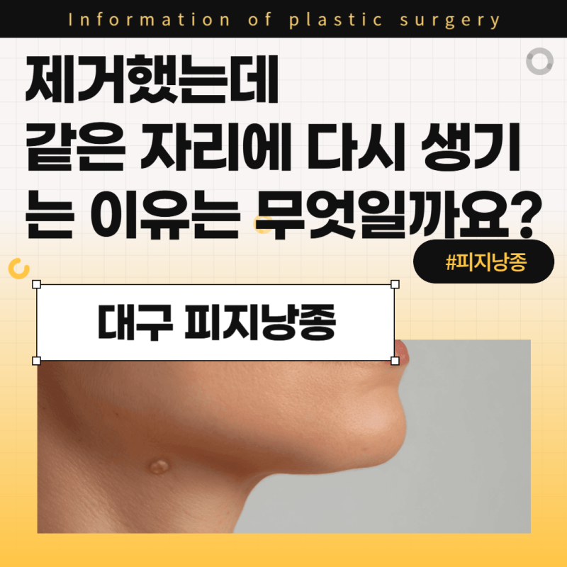 대구 피지낭종, 제거했는데 같은 자리에 다시 생기는 이유는 무엇일까요?