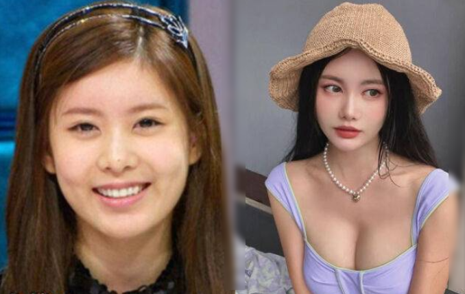 '티아라 큐리' 성형 부작용설 빵빵해진 인형 비주얼 "달라진 이목구비"