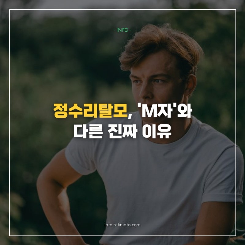 정수리탈모 원인 '이것' 때문에 M자탈모와는 확실히 다르게 진행됩니다