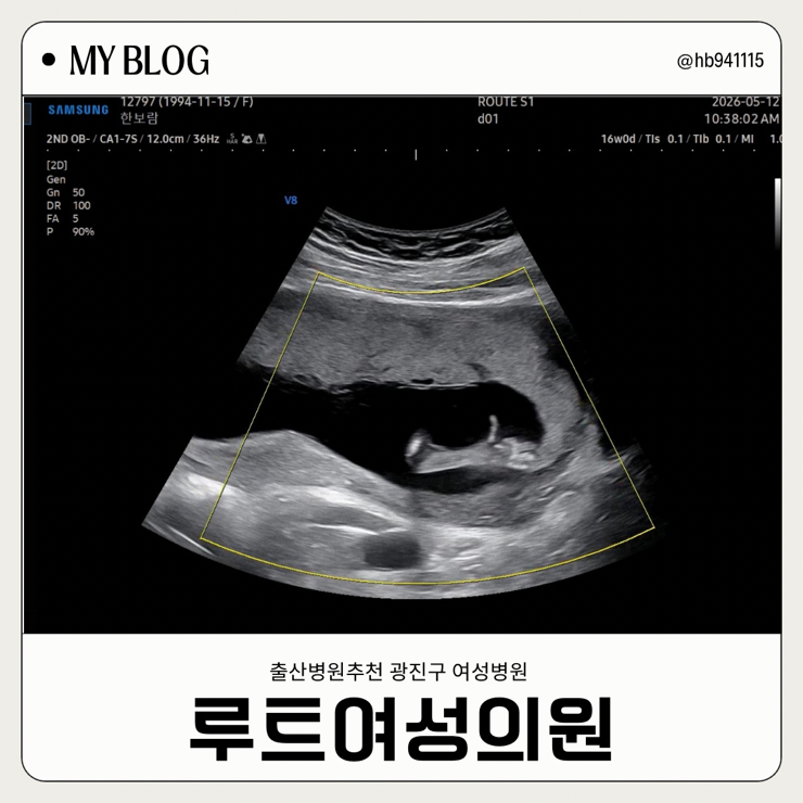 분만병원결정 루트여성의원 솔직후기 이미경원장님 31주차