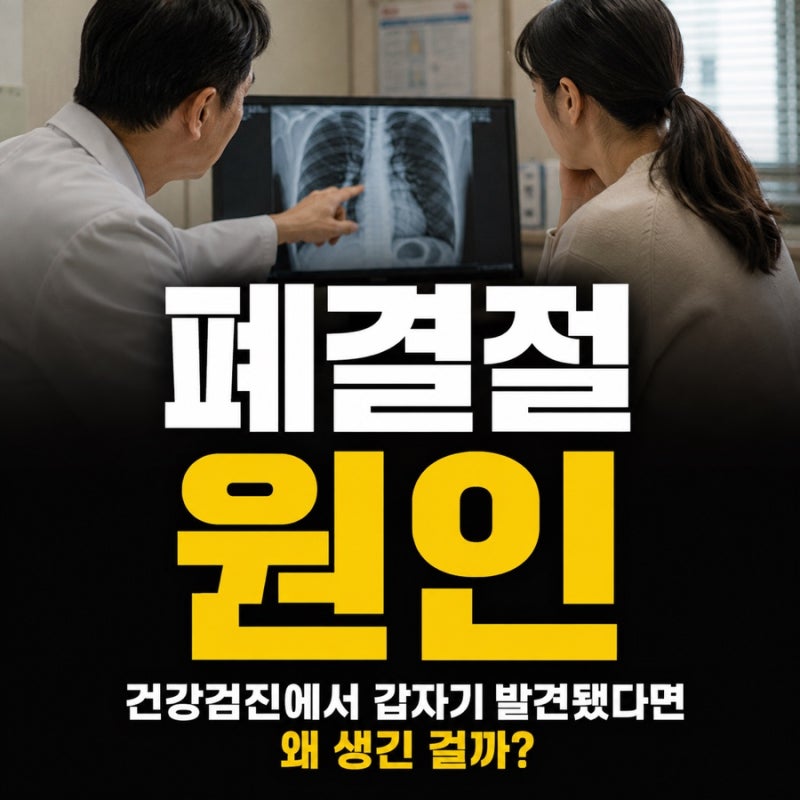 폐결절 원인, 건강검진에서 갑자기 발견됐다면 왜 생긴 걸까