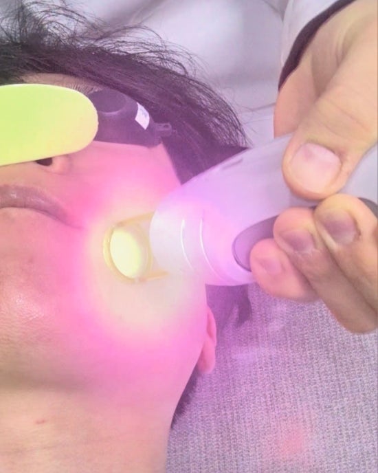 효과좋은 수염제모 피부과 고르는 방법! 2년동안 매달 레이저제모 받으며 깨달은 노하우