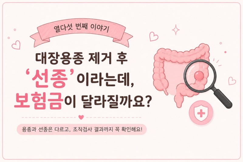 대장용종 제거 후 ‘선종’이라는데, 보험금이 달라질까요?