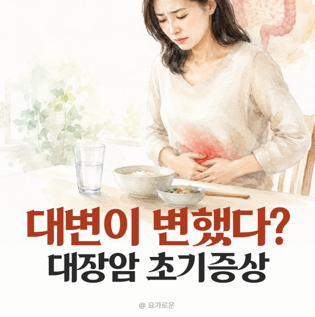 "화장실에서 이것 봤다면?" 대장암 초기증상 대변 변화 4가지