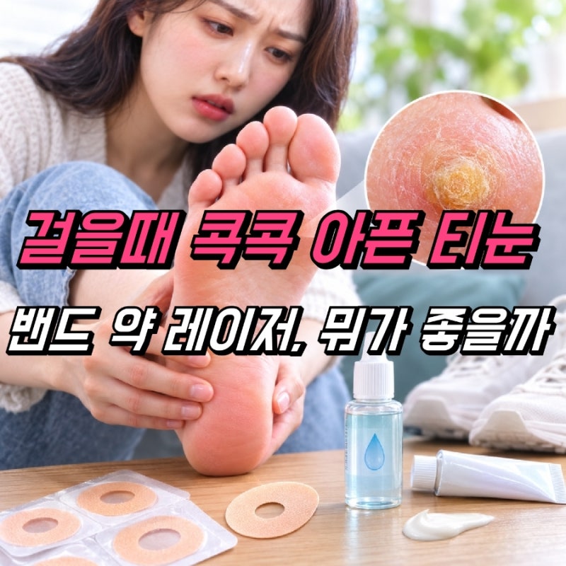 티눈 생기는 이유, 티눈제거 밴드 약 레이저