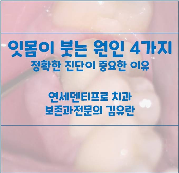 어금니 잇몸 부음 원인 4가지, 정확한 진단이 중요한 이유