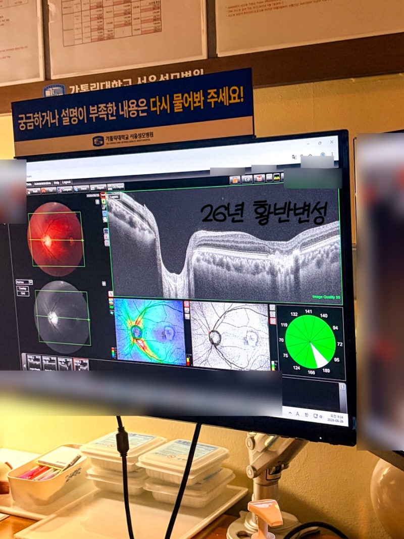 서울성모병원안과 박영훈 교수님 I 30대 황반변성 재발, 어떤 증상이 나타날까? 치료와 관리 ....