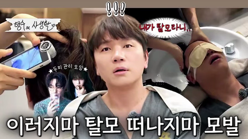 케이윌 마운자로 14kg 감량 탈모 고백, 다이어트 전후 달라진 모습
