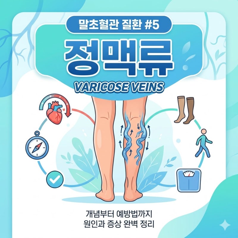 다리 핏줄(정맥류), 그냥 두면 안 되는 이유 (식도, 직장 정맥류까지 알아보기)