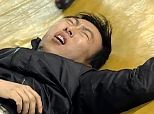 소파술대신 자궁경으로 자궁폴립 용종 제거 후기와 통증