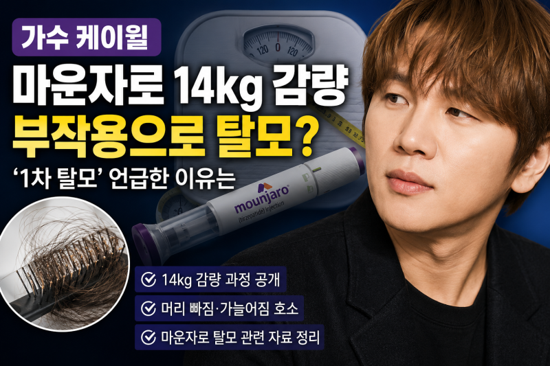 케이윌 마운자로 탈모 이슈 정리, 14kg 감량 뒤 무슨 일이 있었나