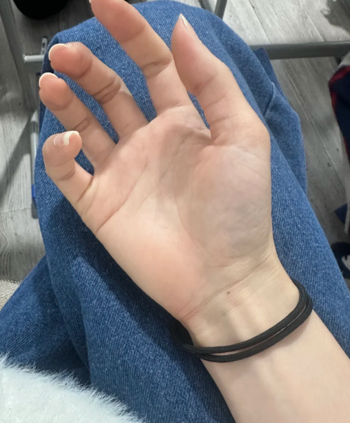 방아쇠수지증후군 스트레칭 손가락 마디가 덜 굳도록 돕는 동작