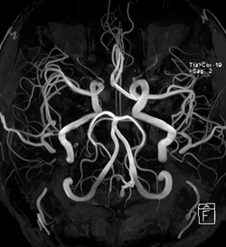 수원 MRI - 검사부터 결과확인까지.