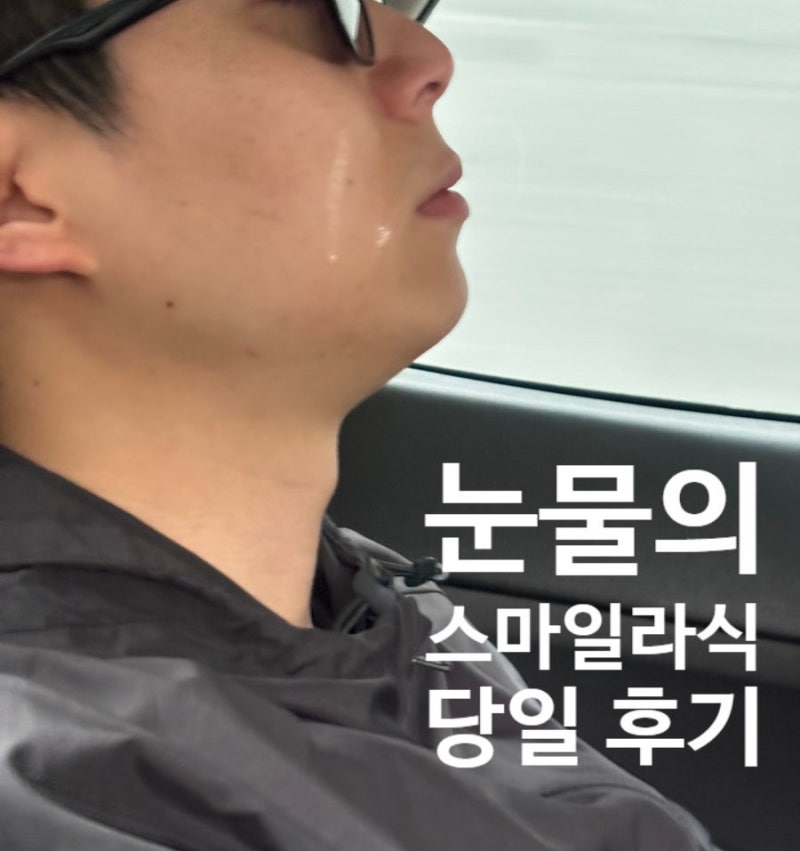 부산 스마일라식 당일 수술 후기! 시력 효과 회복기간 솔직 만족 후기!