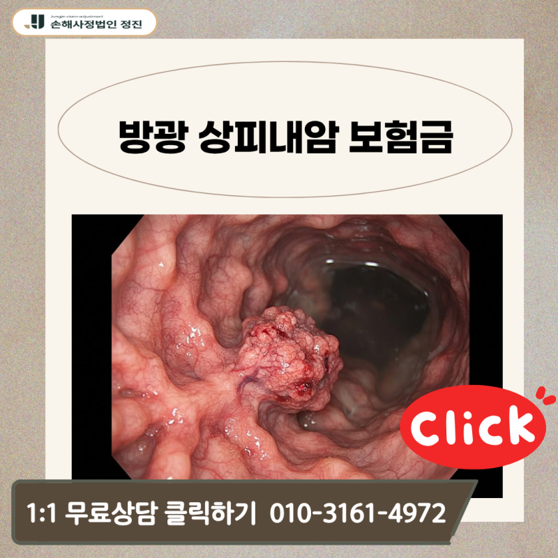 방광 상피내암 보험금, D09 코드인데 C67 일반암 전액 지급이 가능한 이유는?