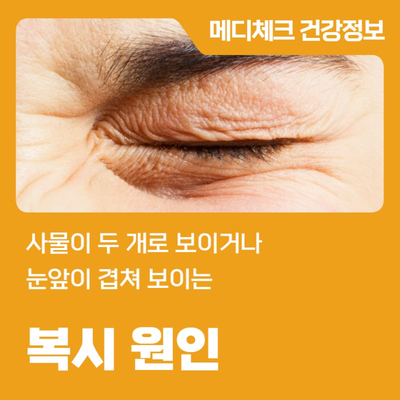 사물이 두 개로 보이거나 눈앞이 겹쳐 보이는 복시 원인