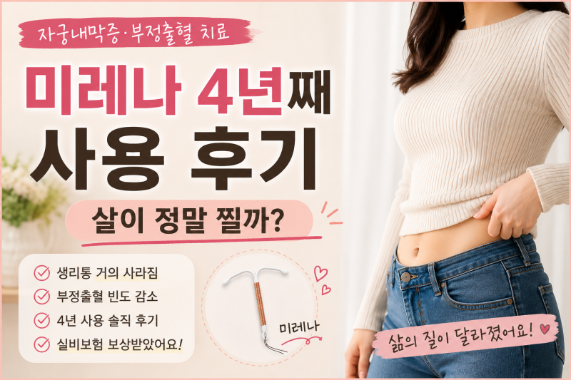 미레나 4년째 사용 후기｜자궁내막증·부정출혈 치료, 살이 정말 찔까?