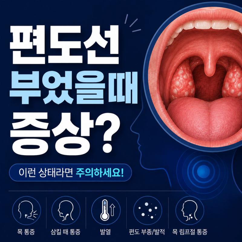 편도선 부었을 때 증상? 이런 상태라면 주의하세요!